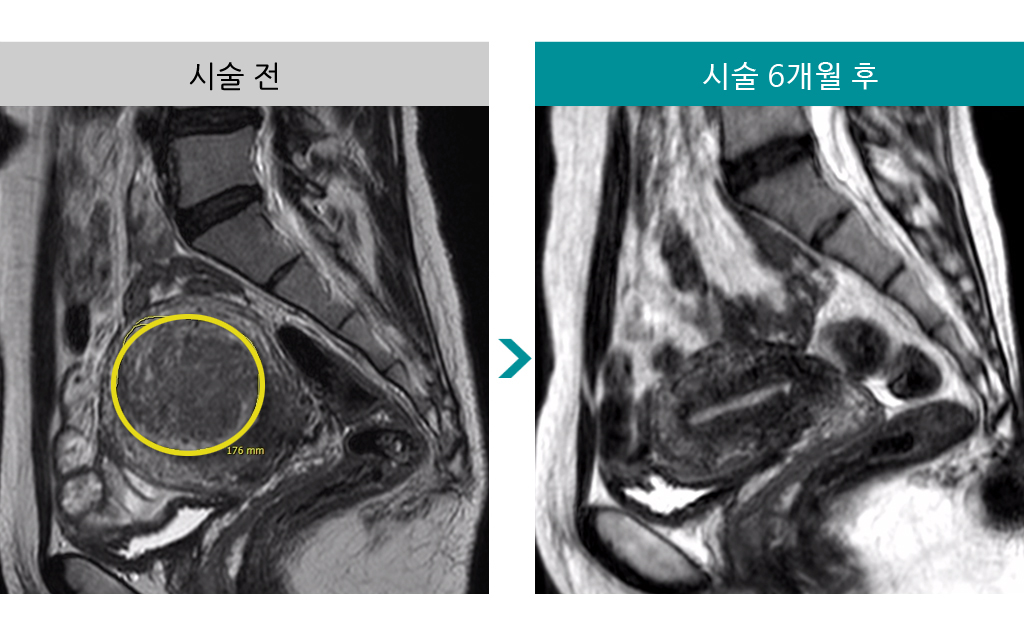 40세색전술.jpg