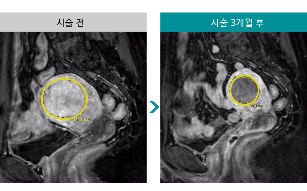 49세색전술.jpg