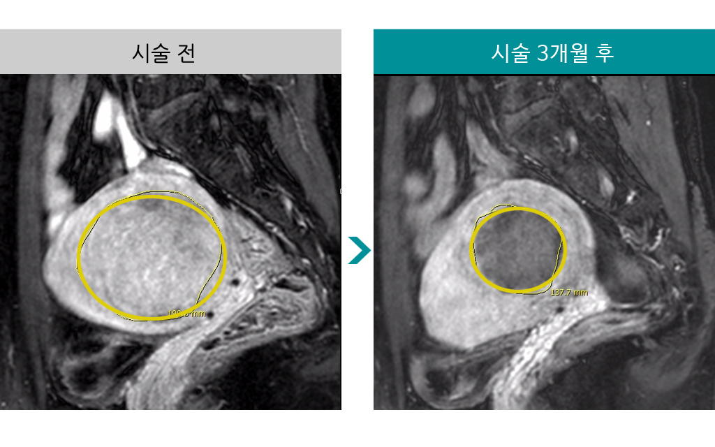 39세색전술.jpg