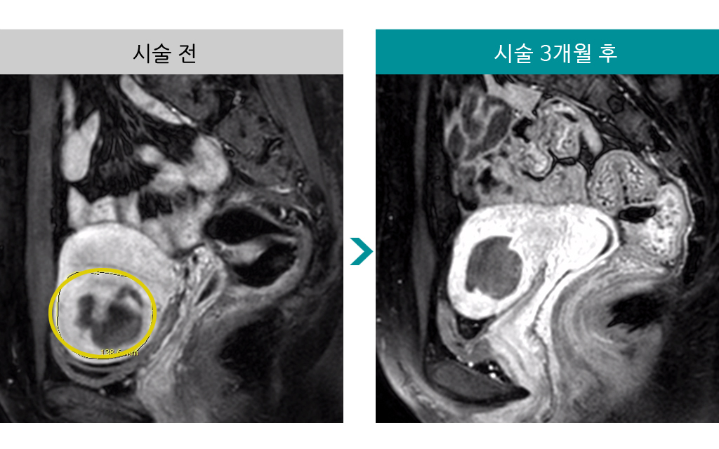 34세색전술.jpg