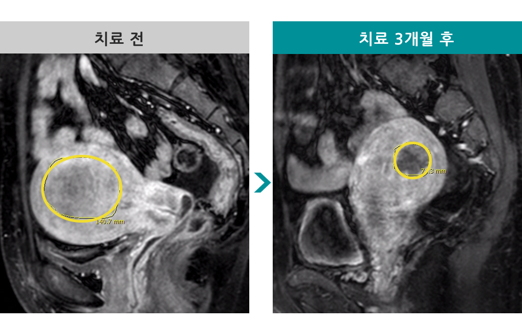 36세색전술.jpg