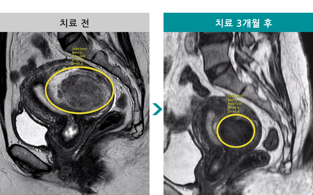 41색전술.jpg