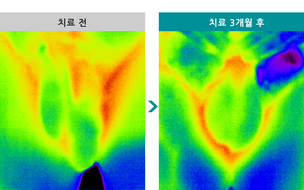 63세정계체온열_수정.jpg