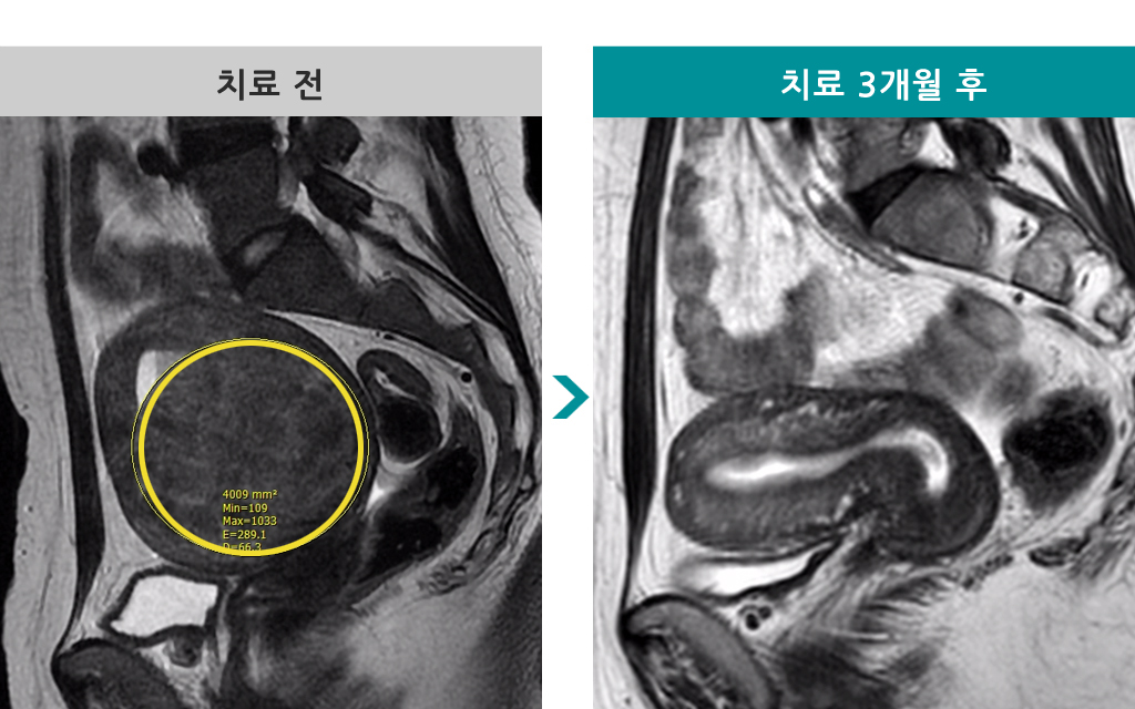 37세색전술.jpg