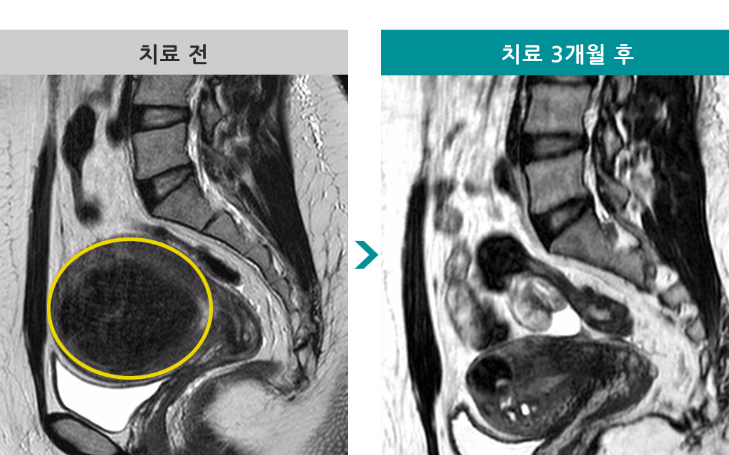 38점막하.jpg