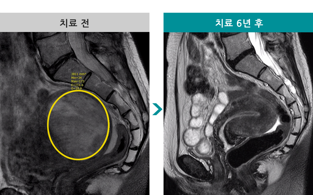 43세6년후.jpg