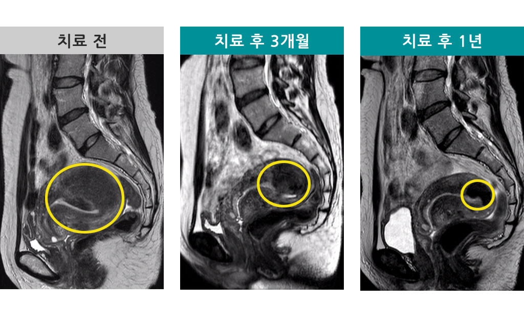 40세선근증색전.jpg