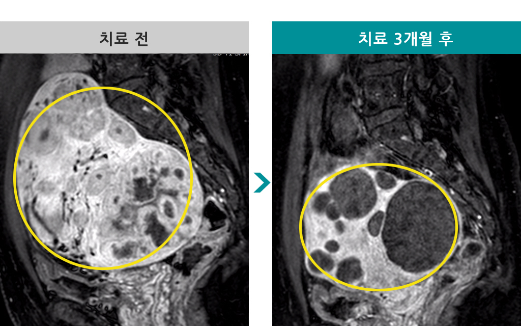 831620색전술43세.jpg