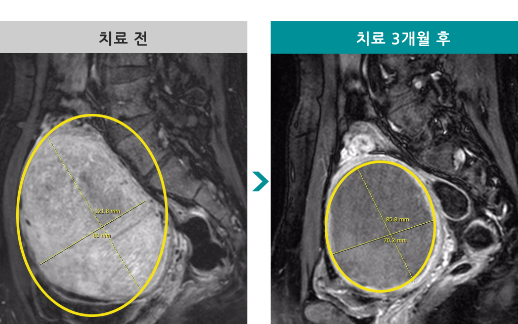 839383색전술.jpg