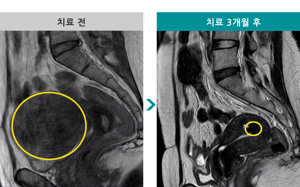 49세선근증색전824480.jpg