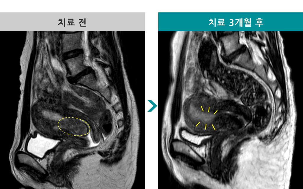 40세하이푸839267.jpg