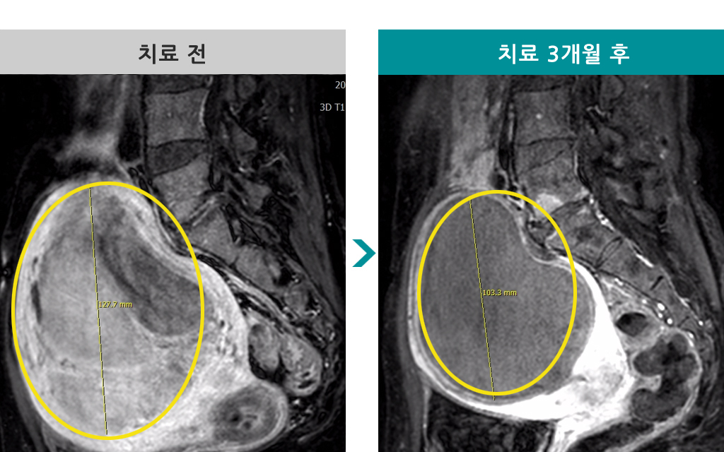 44세색전술.jpg