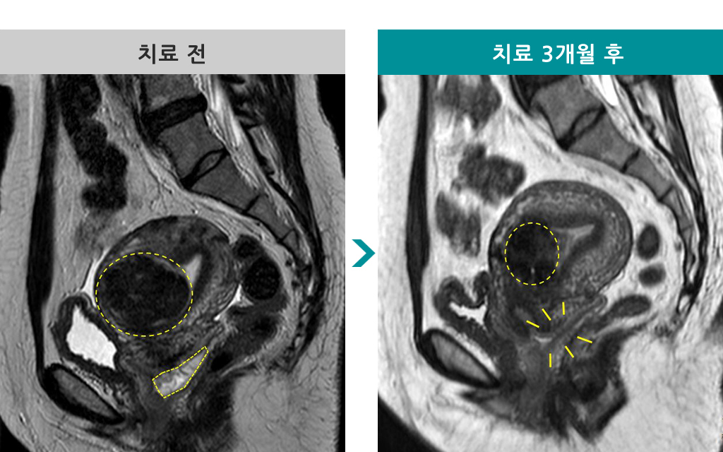 00840565하이푸47세.jpg