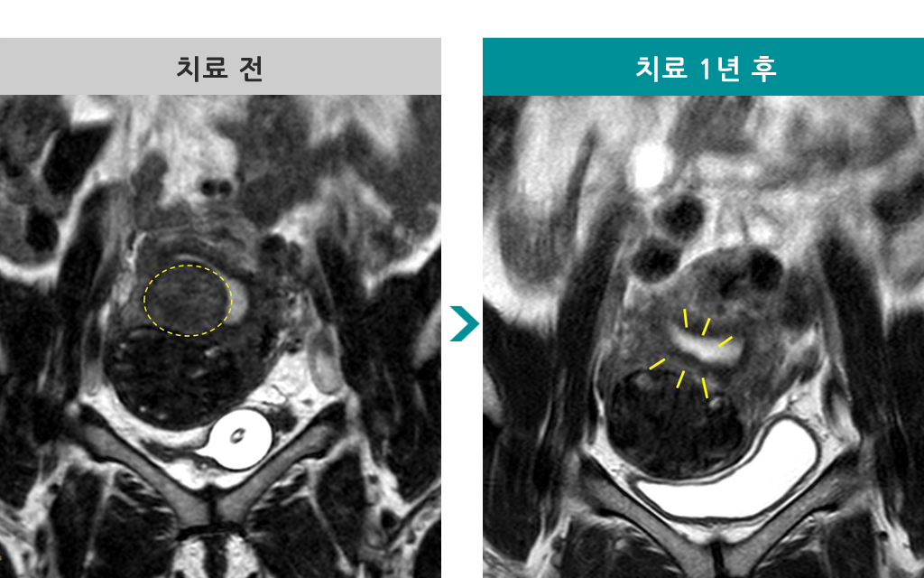 00820665하이푸38세.jpg