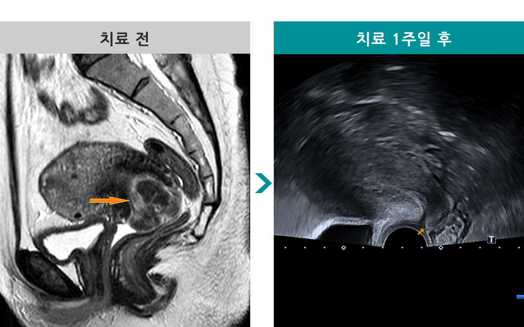 41세자궁경하00820218.jpg