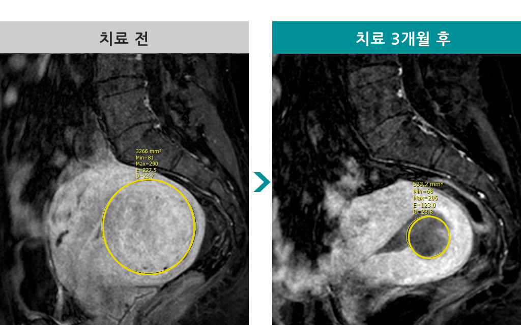 45세색전술00841079.jpg