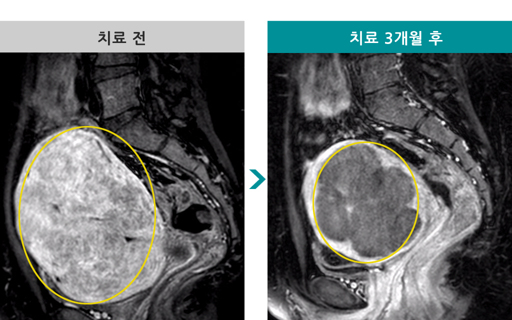 27색전술00831675.jpg