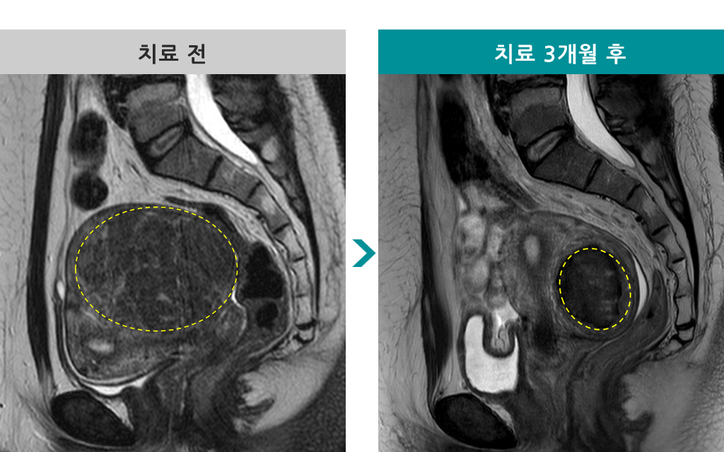 39세엠알하이푸00841404.jpg