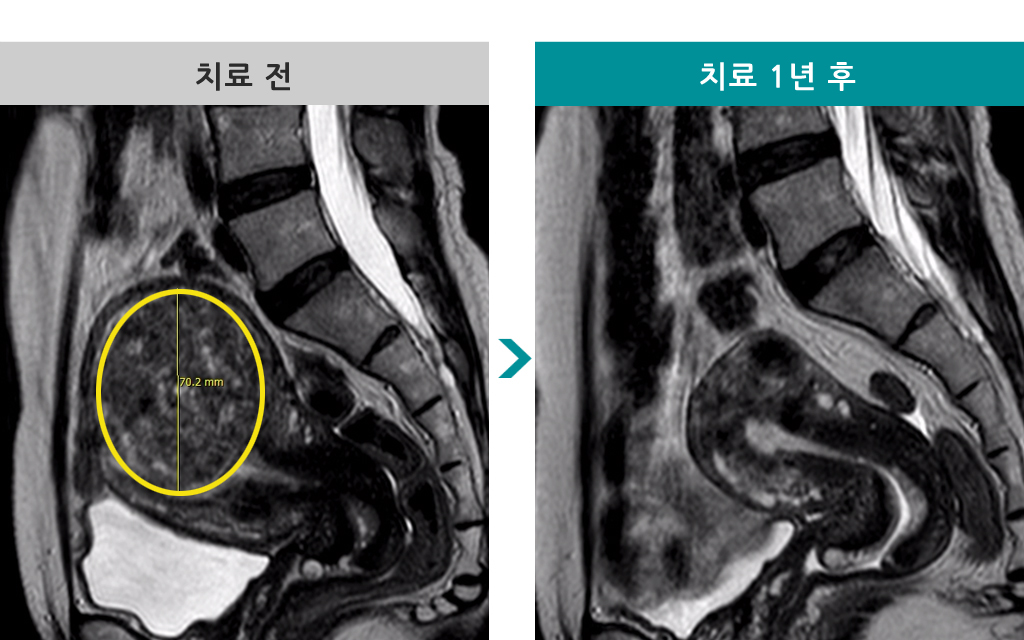 00839526_1년후변경.jpg