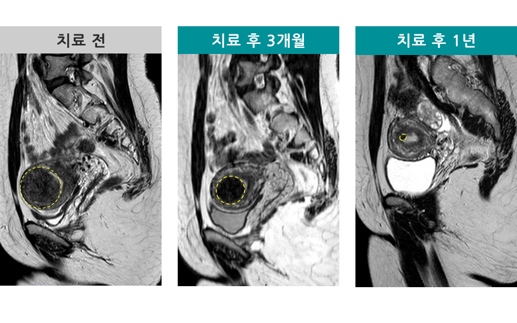 33세_00838649_하이푸.jpg