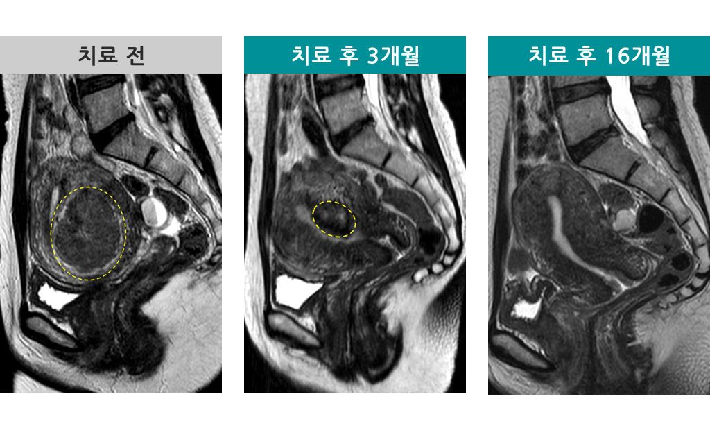 00835225하이푸.jpg