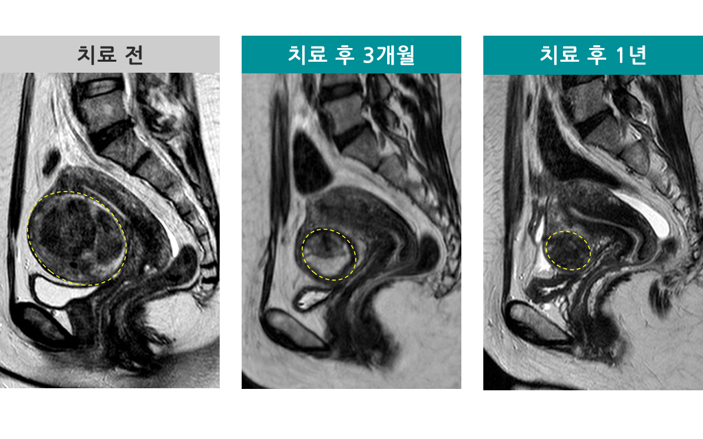 41세008381414하이푸.jpg